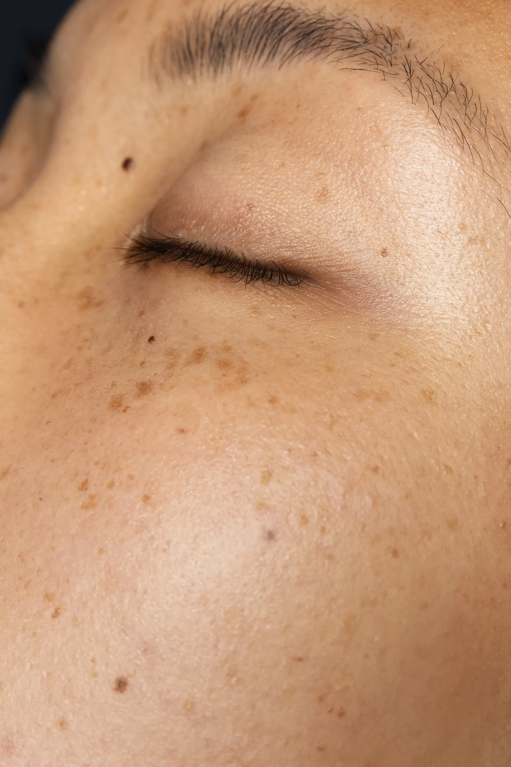 side view woman normal skin texture scaled