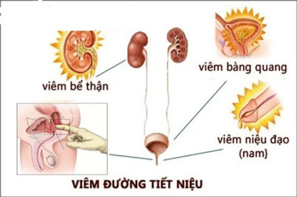 viemduongtietnieu