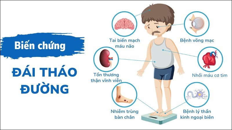 Dai thao duong co the gay ra nhieu bien chung nguy hiem